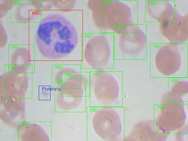 YOLO mendeteksi RBC, WBC, dan platelet pada citra mikroskop