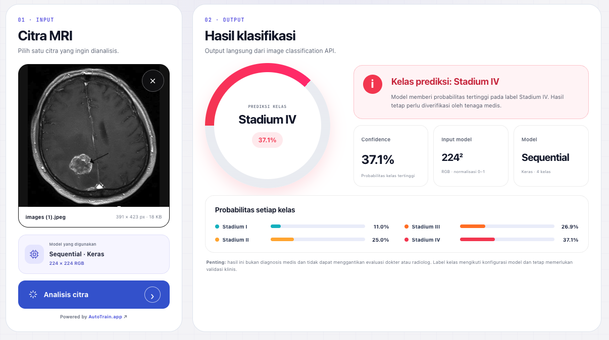 Dashboard klasifikasi tumor otak